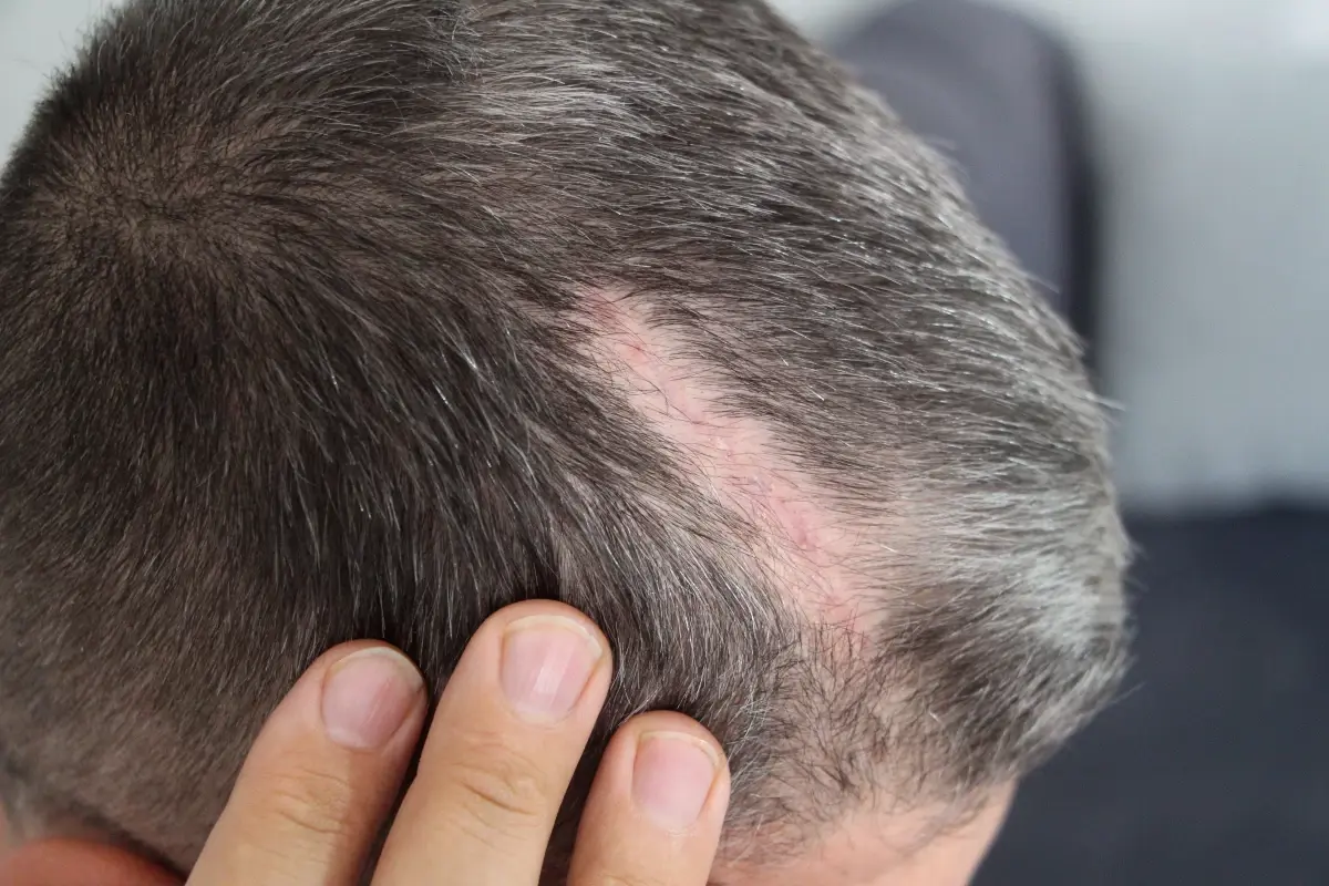 Akraba Kavgası: Can Güvenliği Tehlikede