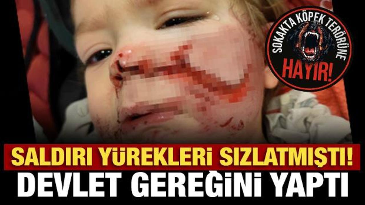 Ankara’da iki kardeşe saldıran köpeğin sahibi tutuklandı