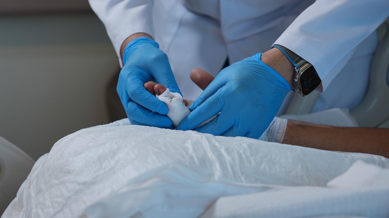 Dakikalarla yarışılan operasyon: Kopan parmak mikrocerrahi yöntemiyle dikildi